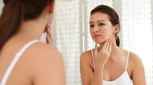 blizny potrądzikowe