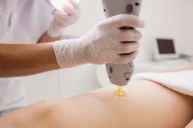 laseroterapia