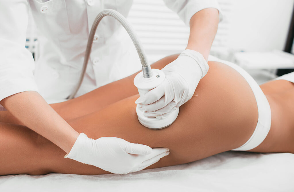 liposukcja ultradźwiękowa