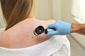 wideodermatoskopia